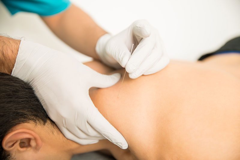 trigger point dry needling las vegas