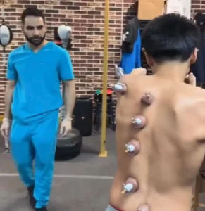 cupping therapy las vegas