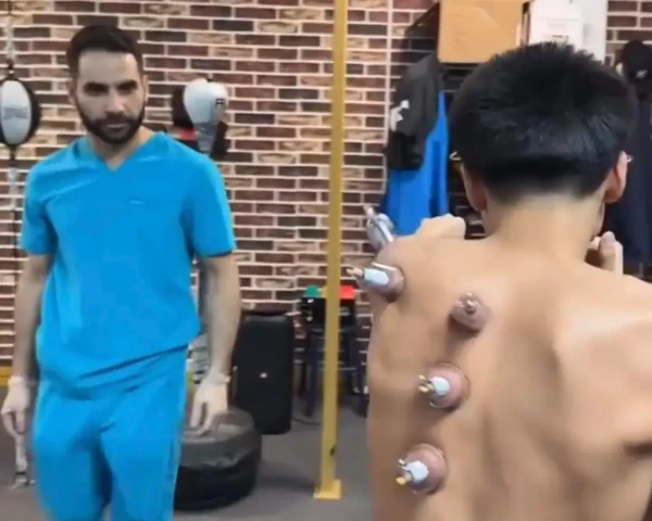 cupping therapy las vegas