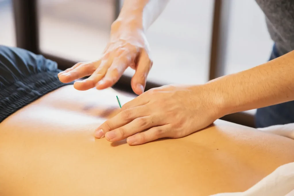 trigger point dry needling las vegas