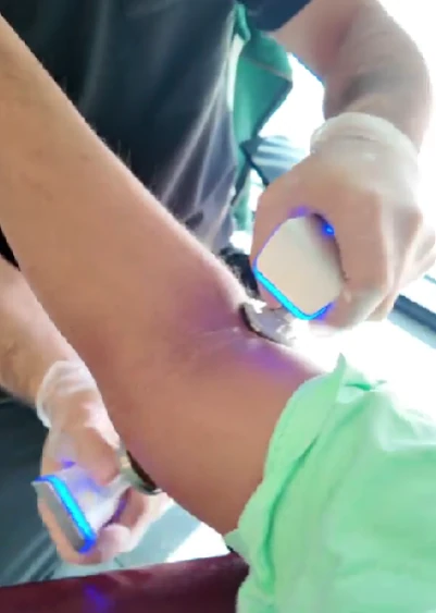 TECAR Therapy Las Vegas